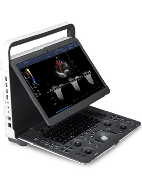 SonoScape E2 Ultrasound