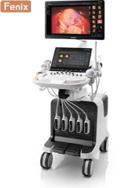 SonoScape P80 Elite Ultrasound