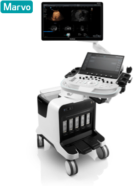 SonoScape S80 Elite Ultrasound