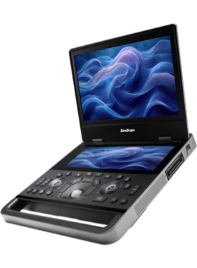 SonoScape X10 Ultrasound